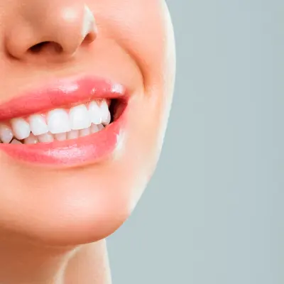 Estética Dental
