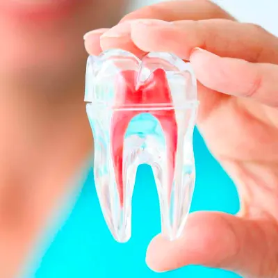Endodontia - Tratamento de Canal